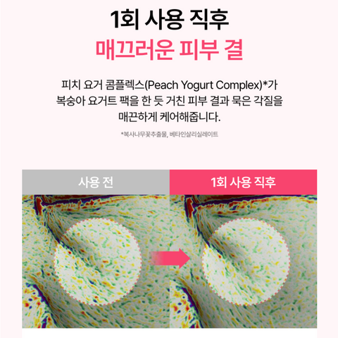 ANUA l 아누아 복숭아 70% 나이아신 세럼 30ml