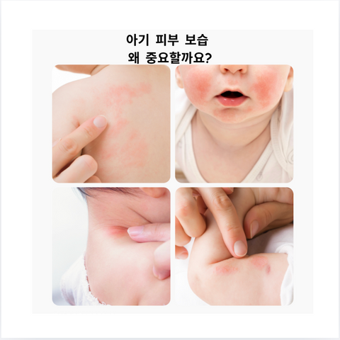 몽디에스 l 아토 로션 300ml 리뉴얼 😀 두개 구매시 수딩젤 추가증정