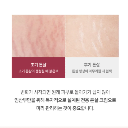 몽디에스 l 마더투비 매터니티 로즈 튼살 크림 200ml